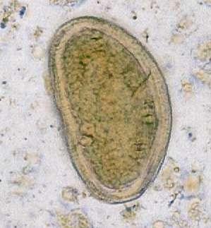 Spor Dicrocelium