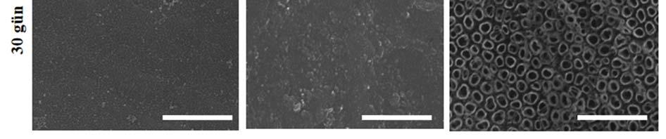 25-HT numunesinde anodizasyon sonucu oluşan nanotübüler yapıların simüle edilmiş vücut sıvısından gerçekleşen kalsiyum fosfat çökelmesi sonucu tamamıyla kaplandığı (Şekil 5b ve 5e), Ti6Al7Nb-HT