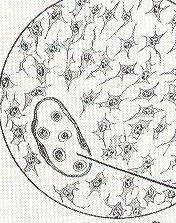 Osteoblastlar osteoid doku Fibröz kemik