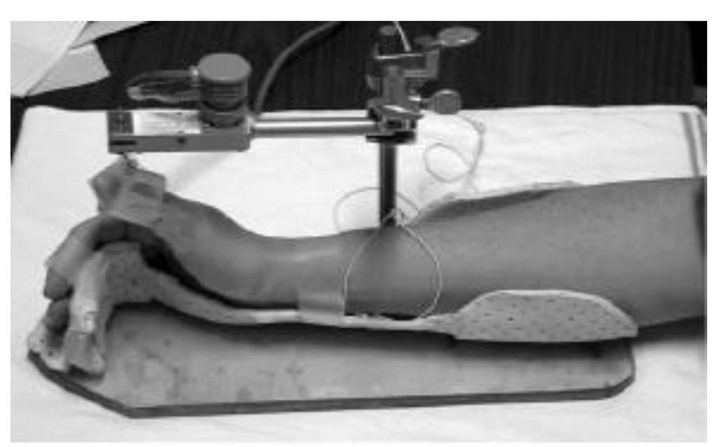 Mekanomiyografi (MMG); Genellikle adductor pollicis kası kullanılır Sonuçların güvenilir olması için el ve önkolun çok iyi bir şekilde atel içinde tespit edilmesi gereklidir Titiz