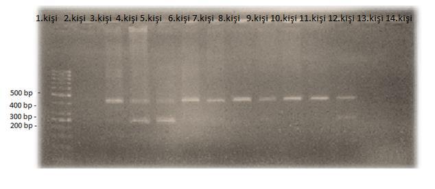 4.2.2. IL1RN VNTR polimorfizm Araştırma kapsamında hasta ve kontrol gruplarının kan dokusundan izole edilen DNA ların IL1RN VNTR polimorfizmi ile ilgili bölgeleri PZR ile çoğaltıldı ve %2 lik agaroz