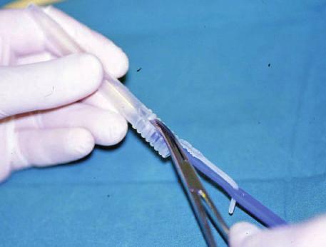 Provox protez taşıyıcısıyla kalem ucun içine, ösefageal kanatları öne doğru kıvrılmış olarak yerleştirilmiş durumda ve hasta uygulamasına hazır Resim 27.