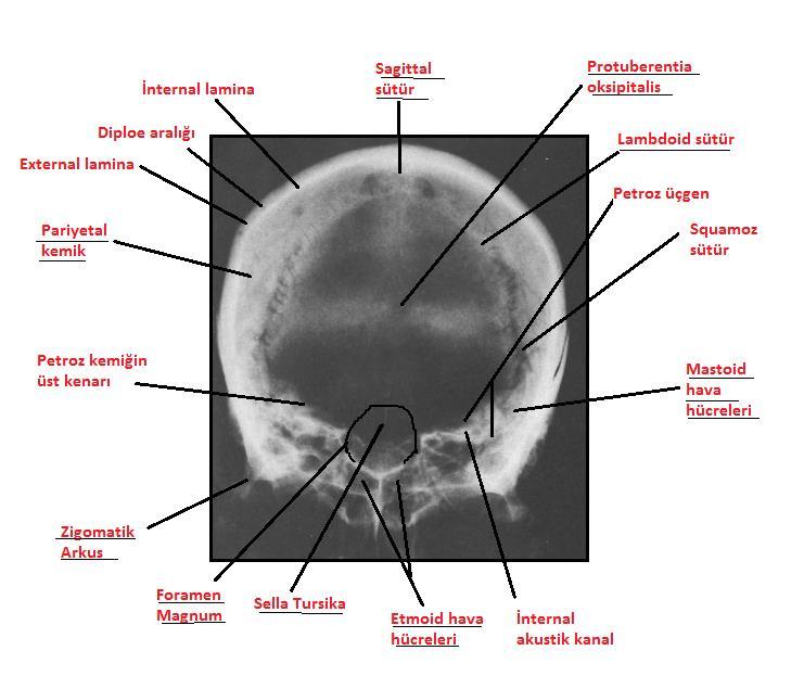 Bu pozisyonda anterior ve posterior klinoidler, dorsum sella eksternal akustik kanal,hipofizeal