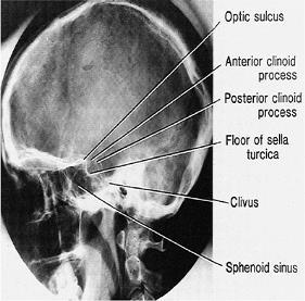 Ders(Çekim Tek-I) Merkezi Işın Merkezi ışın, dış kulak yolunun 2,5 cm önüne ve orbitomeatal çizginin 2,5 cm yukarısına gelecek şekilde dik olarak santralize edilir.