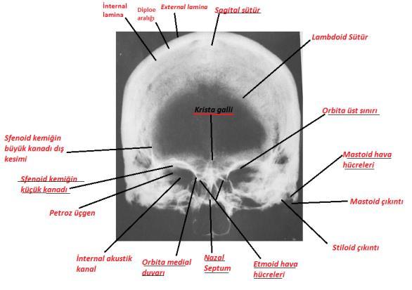 Kafa-Lateral Radyografisi Kafa-P-A radyogramı ve radyolojik anotomisi 31 32 Kafa Lateral Radyografisinin Amacı Kafa lateral radyografisi, kafatasının lateral bölgesinde bulunan anatomik yapılarda