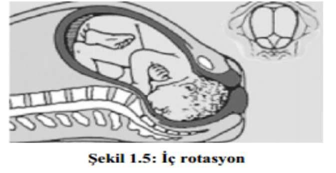 Kontraksiyonların basıncı ile önce ön omuz simfizis pubisten kurtulur.