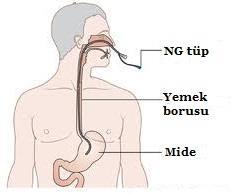 ENTERAL BESLENMENİN ÖNEMİ Enteral beslenme ile mukozal atrofinin azaldığı, barsağın bariyer fonksiyonunun korunduğu, intestinal bakteriyel translokasyonun azalarak düşük morbidite ve maliyet ile