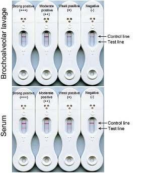 Lateral Flow Device (LFD) İ u kro otografi prensibini kullanmakta Aspergillus tarafı da salgıla a glikoproteine karşı oluşturul uş monoklonal antikoru (JF5 IgG3) kullanmakta