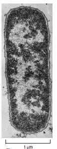coli bakterisinde hücre DNAsı hafif