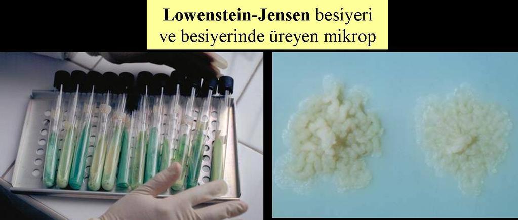 Mikrobu besiyerinde (kültürde) üretmek tanıda altın standarttır. Verem mikrobunu laboratuvarda çoğaltmak için besiyeri kullanılır. Lowenstein-Jensen besiyeri yumurta ile yapılır.