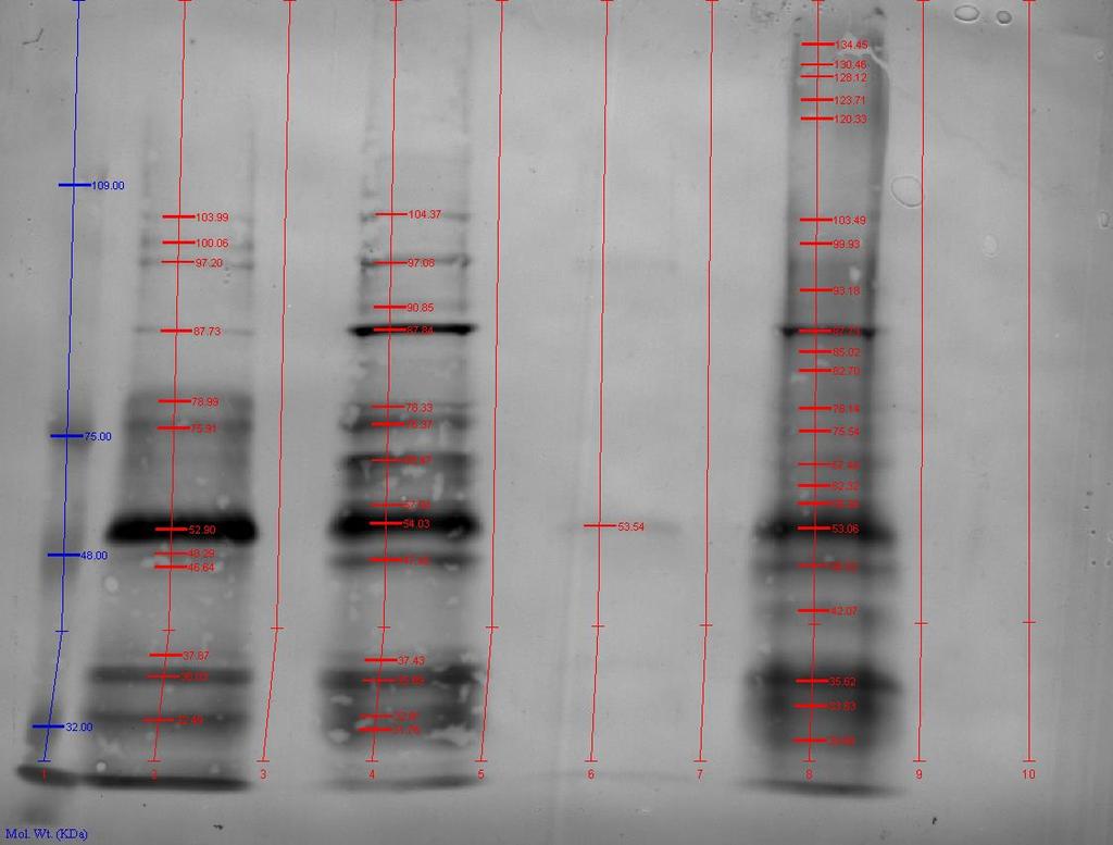 stramonium agglutinin]: Kompleks ve hibrid türdeki N-glikanlarda ve O-glikanlarda Galaktoz beta [1-4] ile N-asetilgalaktozamin bağlantısını tanımaktadır.