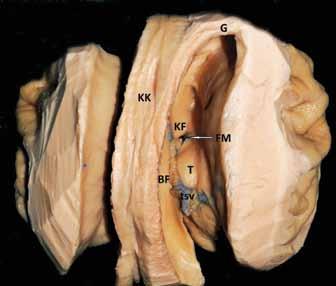 Temporal lobun tavanını talamus inferior yüzeyi ve kaudat nükleus kuyruğu oluşturur. Tavanın lateral kısmı ise korpus kallozumun tapetumu tarafından oluşturulur.
