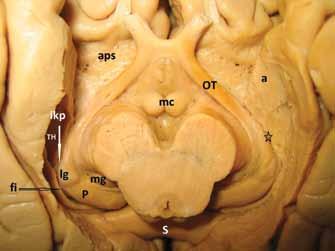 Talamusun lateral ventriküllerle komşuluğu üç boyutlu anatomisinin anlaşılması için önemli ipuçları verir. Her bir lateral ventrikül talamusu süperior, inferior ve posteriordan sarar.