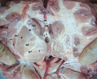 b, korpus kallozum gövdesi. S, korpus kallozum splenium parçası. sp, septum pellusidum. f, forniks. T, talamus. Pi, pineal bez. ht, hipotalamus, ê: Foramen Monro, SG: Singulat Girus.