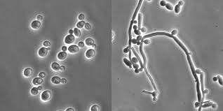 İnvazif Fungal Enfeksiyonlar Candida türleri Aspergillus türleri Pneumocys9s