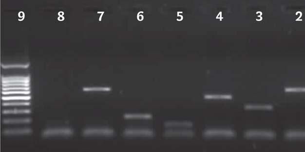 2 serogruplandırma yapıldı 4 (Tablo I). Reaksiyon karışımı; 2.5 μl 10X PCR tamponu (MgCl 2 içermeyen), 3 μl MgCl 2 (25 mm), 0.2 μl dntp (25 mm), her bir primerden (5 pmol/μl) 0.5 er μl, 0.