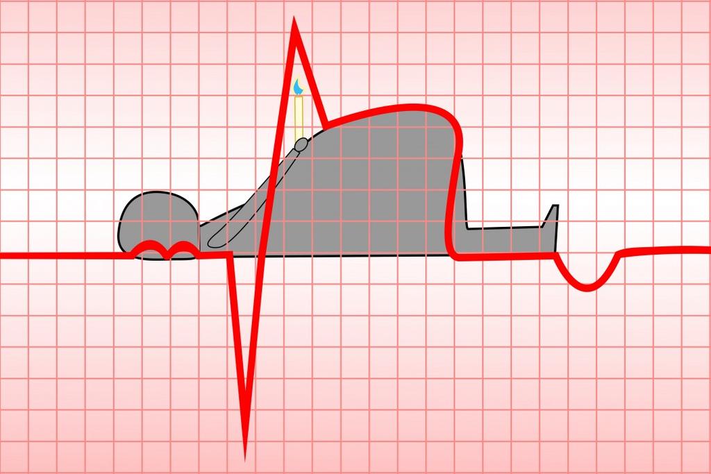 Sağlık sorunları BMI>30 mortalite ve morbidite artar BMI>35