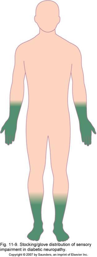 Organofosfat ile indüklenen gecikmiş nöropati (OPIDN) Geçici, ağrılı ""stocking-glove"" parestezileri Simetrik motor polinöropati Duyu bozuklukları genellikle hafif Esas olarak distal kas