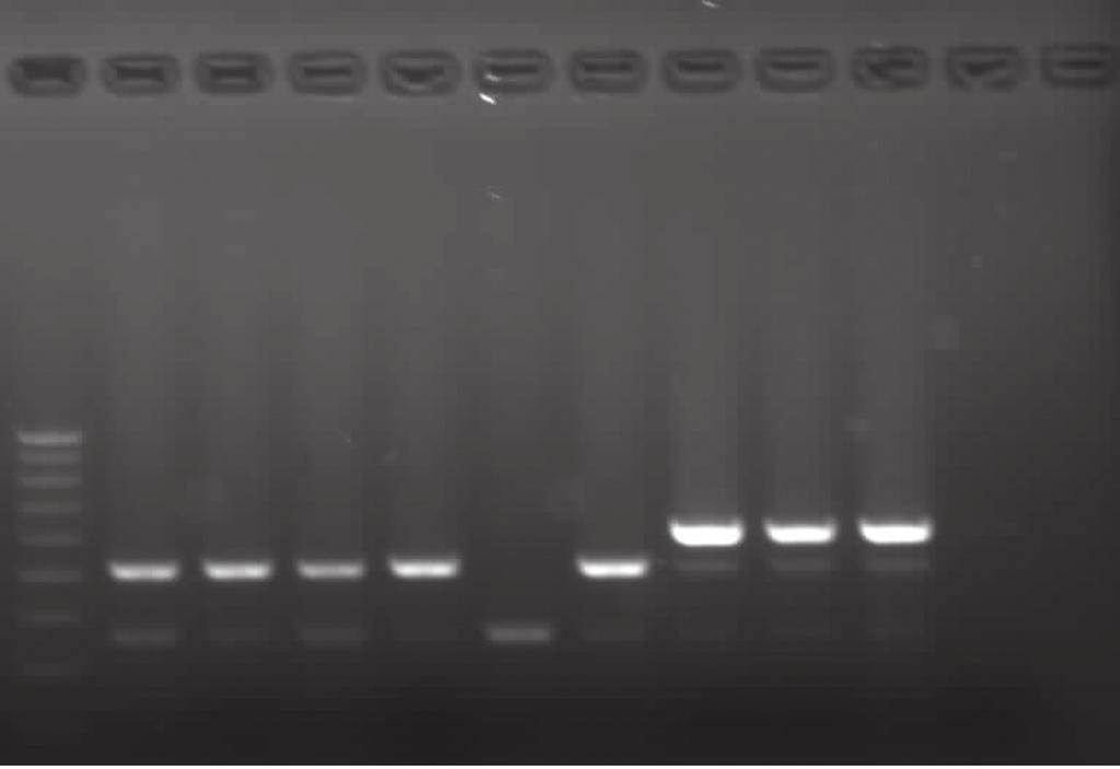 Türk Mikrobiyol Cem Derg 47(4):190-196, 2017 Oxa58 Oxa23 Oxa51 Şekil 2. Multipleks PCR reaksiyonu ile OXA pozitif seçili izolatların jel görüntüsü.