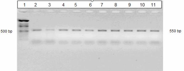Şekil 11.a: Cryptosporidium spp. saptanan olguların %1 agaroz jelde PCR sonuçları. 1: Marker (100 bp ladder). 2: Cryptosporidium spp. pozitif kontrol. 3-11: Cryptosporidium spp.