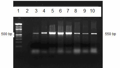 4-10: Cryptosporidium spp. pozitif olgular. PCR ile pozitif değerlendirilen PCR ürünlerine tür ayrımı yapmak amacıyla RFLP yöntemi uygulandı.
