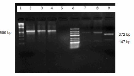PCR ile Cryptosporidium spp. saptanan olguların RFLP görüntüleri Şekil 12 de verilmiştir. Şekil 12.a: Cryptosporidium spp. pozitif olguların % 2 agaroz jelde RFLP sonuçları. 1: Marker (100 bp ladder).