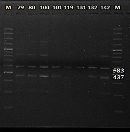 01 alleli 12. intron içinde başlayıp 8.5 kb delesyon ile karakterize ediği için A* ve O1 varyantlarının ayırt edilmesi amacıyla 12. intron AS-PCR analizi gerçekleştirilmiştir. Analiz sonucu Şekil 4.2. de görüldüğü gibi sadece 281bç uzunluğundaki bantlar tespit edilmiş olup bu sonuç A* gurubu allellerin varlığını göstermiştir.