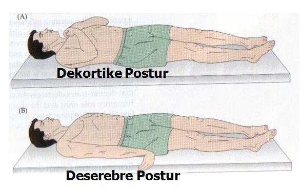 10 Resim 1. Ağrılı uyarana yanıt 1.9.2 Bilinç düzeyi Bilinç; kişinin kendisinin ve çevresinin farkında olması ve yeni uyaranlara karşı uyum sağlayabilmesidir. Bilinç seviyesi doğrudan ölçülemez.