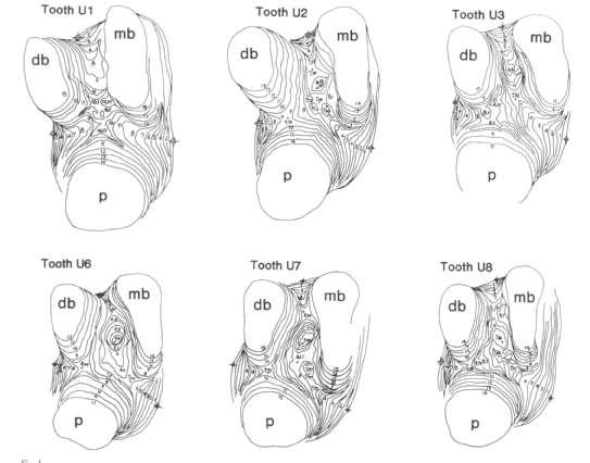 Svardström ve Wennström J Clin Periodontol 1988; 15: 271-275 Furcation