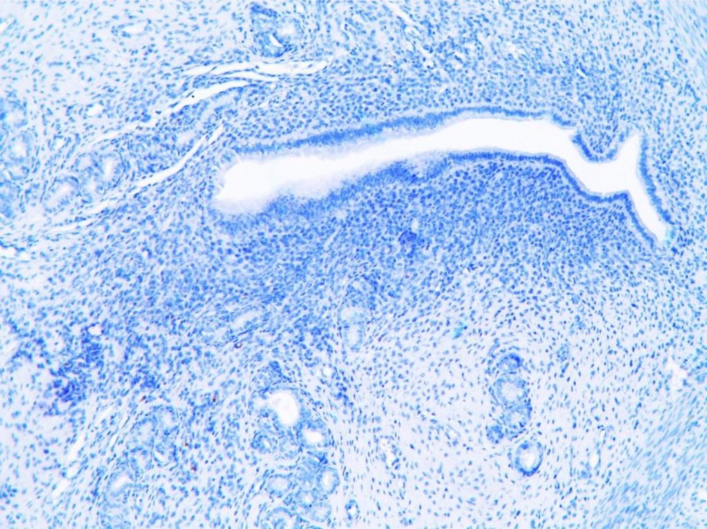 uterus endometriyum epitel dokularında gözlenen SPARC immunoreaktivitesi hipertiriodi grubunda artmıştır (P<0.05; Şekil 41,49).