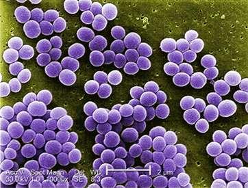 Staphylococcus aureus 24.