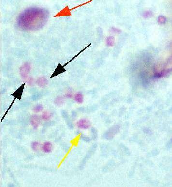 Enterocytozoon bieneusi Encephalitozoon intestinalis Duodenal aspirat, biyopsi örnekleri Sporlar kültürde 8hf.dan sonra (bulanıklık şeklinde) görülür.
