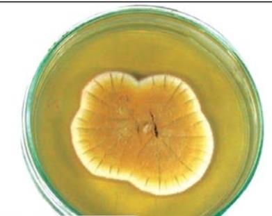 Aynı balgamda Aspergillus terreus ve Candida krusei üredi.