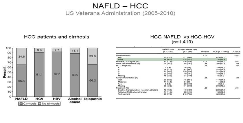 USA: Nonsirotik NAFLD ilişkili HCC:%34.