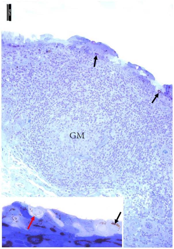 Şekil 4. FAE hücreleri tarafından hücre içine alınmış ferritin partikülleri (siyah oklar), M hücresi (kırmızı ok), germinal merkez (GM). Toluidine blue boyaması. Figure 4.