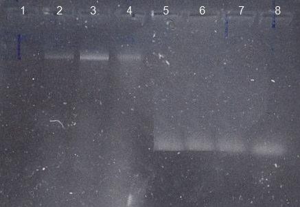 1a da daha keskin tek bir bant oluşmasının bu örneklere ilişkin DNA izolasyonlarının DNA doku kiti ile yapılmış olduğundan kaynaklandığı tespit edilmiştir. Kit ile daha temiz DNA elde edilebiliyor.