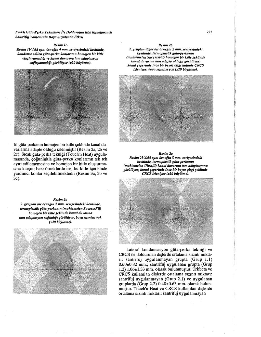 Farktı GÜta-Perka Teknikleri İle Doldurulan Kök Kanallarında Santrifüj Yönteminin Boya Sızıntısına Etkisi Resim 1c. Sesim Ib'deki aynı örneğin 4 mm.