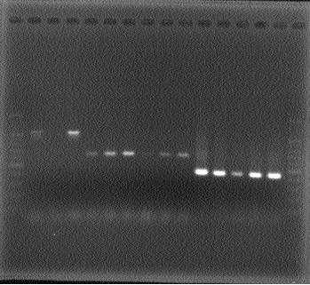 Bu sonuçlar 3 farklı primer setleriyle yapılan PCR amplifikasyonunda patojenin Pseudomonas savastanoi pv. savastanoi olduğunu göstermektedir.