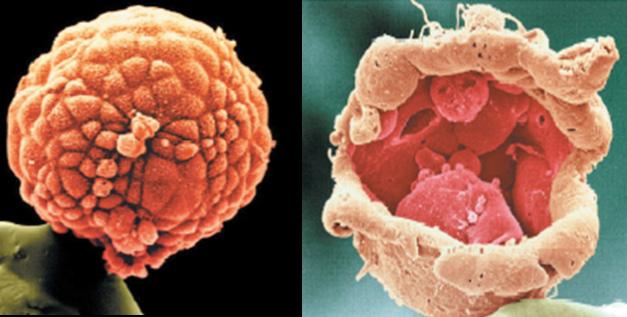 KÖK HÜCRE 109 Şekil 2: Blastokist evresindeki embriyo B) Embriyonik kök hücreler laboratuvarda nasıl yetiştirilirler?