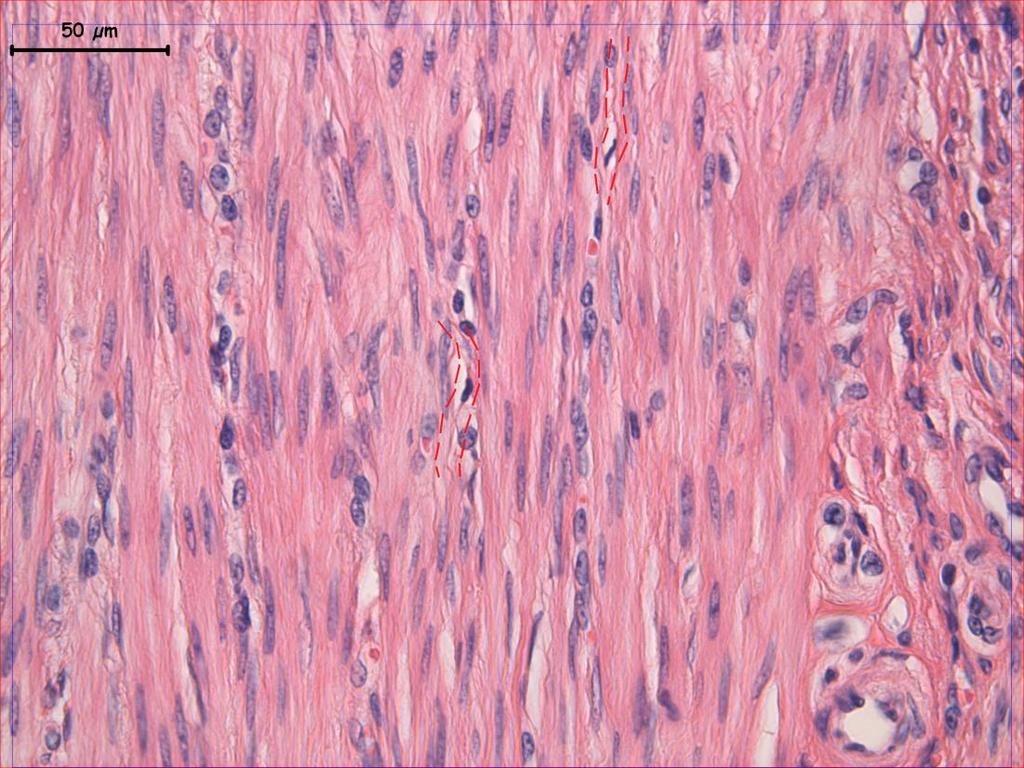 fib DK Fotoğraf 4. Uterus dokusunun miyometrium tabakasında yapılan Hematoksilen-Eosin boyamasında; düz kas hücreleriyle bağlantı kurmuģ olan ICLC ler (kırmızı ok) dikkati çekiyor.