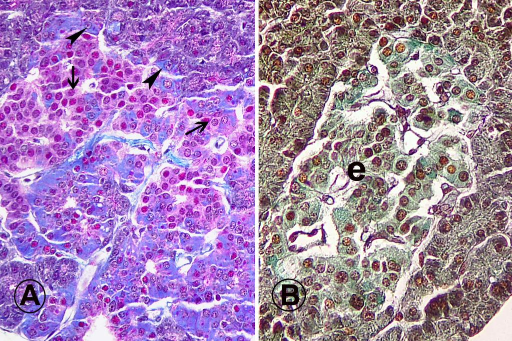 14 Nejdet Şimşek - Emel Ergün - Levent Ergün Şekil 3. Carnoy tespitli pankreasta A ve B hücrelerinin belirlenmesi.
