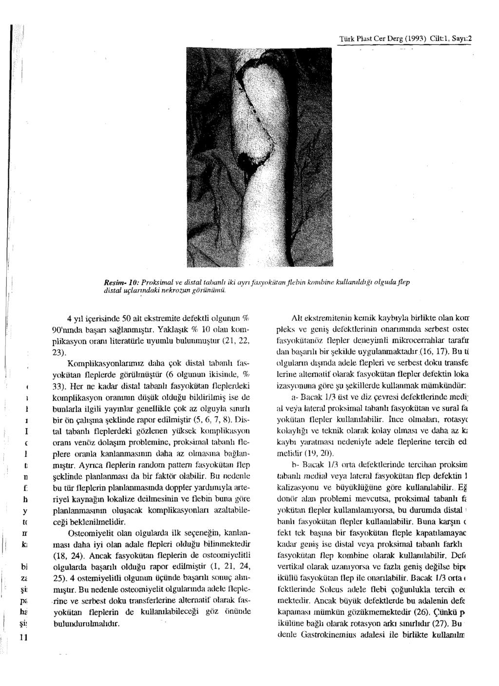 Türk Plast Cer Derg (1993) Cilt: 1, Sayı:2 Resim-10: Proksimal ve distal tabanlı iki ayrı fasyokütan flebin kombine kullanıldığı olguda flep distal uçlarındaki nekrozun görünümü.