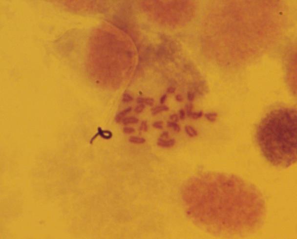 belirlenmiģtir (Resim 3.6). Resim 3.6. Dorcadion anatolicum un erkek birey testisinden elde edilen mitotik metafaz plağı (2n=24) 10µ 3.5.