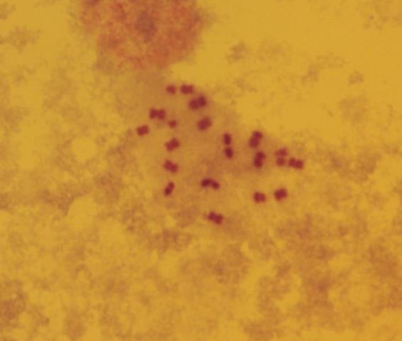 10µ Resim 3.8. Dorcadion scabricolle nin erkek birey testisinden elde edilen mitotik metafaz plağı (2n=20) ALT FAMİLYA: Lamiinae Latreille, 1825 TRİBUS: Agapanthiini Mulsant, 1839 3.6.