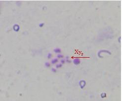 Sitogenetiği: Oxylia argentata nın erkek birey testis dokularından elde edilen metafaz plağında türün haploit kromozom sayısı (n=9+xy p