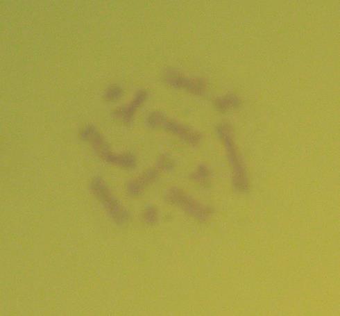 Sitogenetiği: Stenopterus rufus un erkek birey testis dokularından elde edilen plaklarda (metafaz sonu anafaz baģı) türün haploit kromozom sayısı (n=5+xy p ), diploit kromozom
