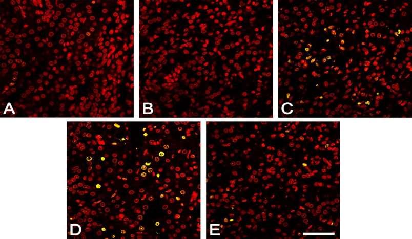 CASPASE-3