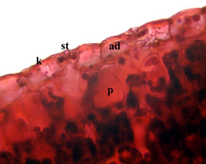 Kesitte iletim demetleri etrafında demet kını hücreleri net seçilememektedir.