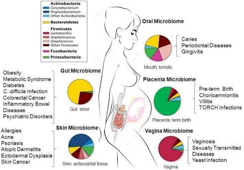 VAGİNAL MİKROBİYOMUN PTB DE ROLÜ NEDİR? LAKTOBASİLLUS (iners, crispatus) DOMİNANT VAGİNA ASCENDİNG İNFEKSİYONLARA KARŞI BİR BARİYER OLUŞTURUR. GEBELİK İLERLEDİKÇE VAGİNAL MİKROBİOM (L.