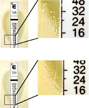 Glikopeptide duyarlı olmayan Staphylococcus aureus (MRSA) Glikopeptidlere duyarlı olmayan Staphylococcus aureus un saptanması için önerilen yöntemler Makro gradiyent testi: Vankomisin için azalmış